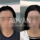 어드반SMP 이미지