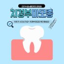 수성뉴플란트치과의원 네이버블로그