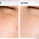 엔케이 | 칙칙한 얼굴 빛을 환하게 밝혀준 룰루뷰 엔케이셀 멜라클리닉 크림 사용 후기