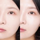 (주)준메디케어 | 속건조 잡는 법 찾다 정착한 메디테라피 히알루론산 세럼