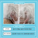송보청기