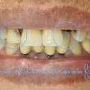 덴탈아트치과기공소 이미지