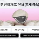 골드 크라운