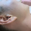 미고 테라피 이미지