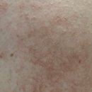 울산중구시니어클럽(희망도시락식당) | [임신31주-32주] 서대문보건소 행복한 예비 엄마아빠 출산교실, 그리고 몸의 이상 (임신소양증, 편평...