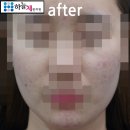 굿모닝한의원 | 대전주사피부염한의원 치료 시 꼭 구분해야하는 피부질환들