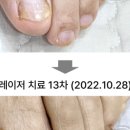 광주본튼튼365의원 네이버블로그