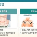 서울아산병원(20대)