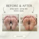 하이푸스 네일조아 응암점