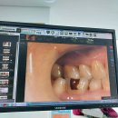 미라인여성의원 | 쌍문역 임플란트 전문 치과 잘하는 곳 추천 TOP 6곳