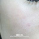 피에이치포스 이미지
