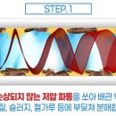수도크리닝 이미지