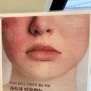 뷰메디칼 | 울산 피부관리 (더뷰에스테틱) 울산트러블관리 후기