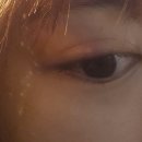 서울성모안과의원 | [원흥역 :서울성모안과의원] 다래끼 항생제 처방