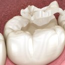 퍼즐치과기공소 이미지