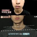 삼성바른아이치과 네이버블로그