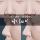 닥터로미성형외과의원 | [경기:안양시:범계역] 닥터로미 무보형물 코수술 상담 후기, 가상성형 자연스러운 코성형외과