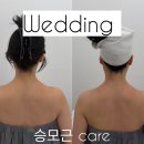 에이원시스템 | 대구웨딩관리 드레스라인 고민 해결한 관리 후기,에이원뷰티