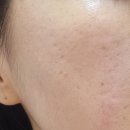 주식회사 벳솔루션 | 스텔라벳 10GF포볼류마이징세럼 보습 진정 주름개선 한번에