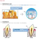 애터미 치약이 왜 좋은지 아시나요! 이미지