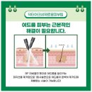 서율가에스테틱 | 서율가 에스테틱 닥터아크네제로 관리 피부 개선에 도움되고 좋아요!