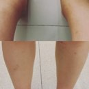 홍쌤테라피 네이버블로그