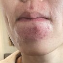 이룸이비인후과의원 | 양준상의원에서 여드름, 비염, 생리통, 변비 등등 다 낫고 체력 얻은 후기-1