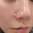 AM메디칼 | 코조각주사 처음이라 고민된다면? 부산피부과추천 내돈내산 솔직 후기