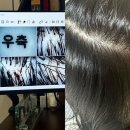 보보한의원 | 잠실 한의원 지루성 두피 탈모관리 후기