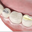 바로나치과의원 이미지