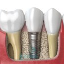 군포본플란트치과의원 이미지