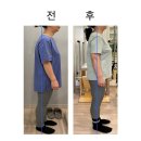 2020027 | [대전중리동 물리치료] 허리 통증 기구필라테스로 해결될까?