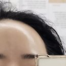 (주)아미 | 진월동피부관리 <아미에스떼> 건조피부 장벽회복 수분관리 후기