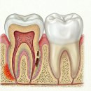 한양치과의원 | 이빨 재교정 2년을 다시 고생하기 싫다면 보세요