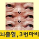 경희미한의원 네이버블로그