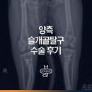 토토PC | 평택 슬개골탈구 3기 전문 동물병원 강아지 맞춤형 수술 후기