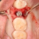 애플치과기공소 이미지