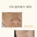더에이치에스테틱