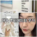 내돈내산 대구 루비레이저 후기 / 팝업 갔다가 급 잡티관리 받은 썰