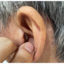 더365 보청기 이미지