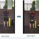 내측인대파열후 재활운동방법 [영상첨부] 이미지