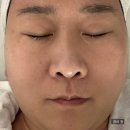 중원-77 | 성남 피부관리 맛집 발견! 금광동 뷰티피아트 플라즈마관리 후기