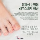 레푸스 구로점 이미지