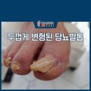 레푸스앤네일 네이버블로그