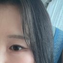 아이라이트 | 청주 눈밑필러 레스틸렌 아이라이트 후기