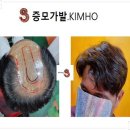 터미널가발