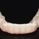 아름다운치과기공소 이미지