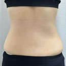 구로디지털단지웨딩케어ㅣ1회만으로 효과보는 에너지테라피 잘하는 살롱드세이렌