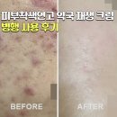 한창약국 | 피부착색연고 약국 재생 크림 병행 사용 후기