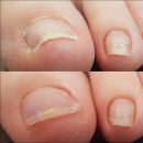 나비네일 이미지